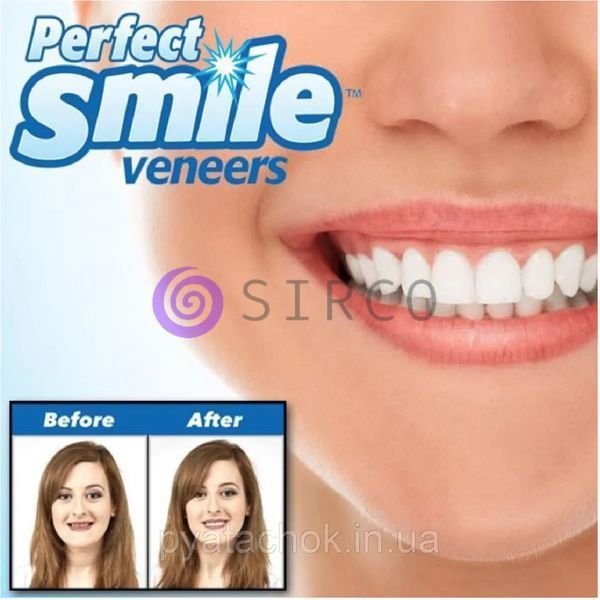 Съемные виниры, Вставка для зубов Perfect smile 06k05p014 фото