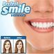 Съемные виниры, Вставка для зубов Perfect smile 06k05p014 фото 2
